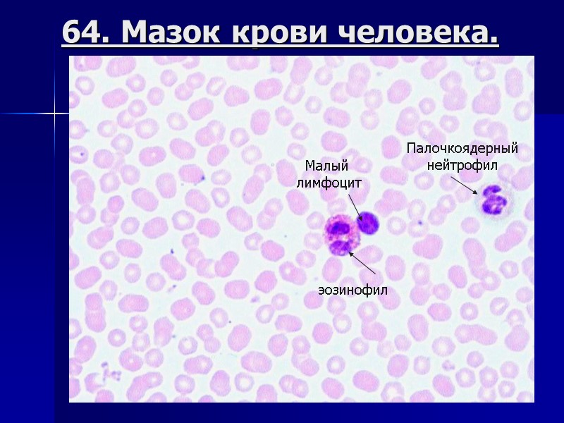 64. Мазок крови человека. эозинофил Малый  лимфоцит Палочкоядерный нейтрофил